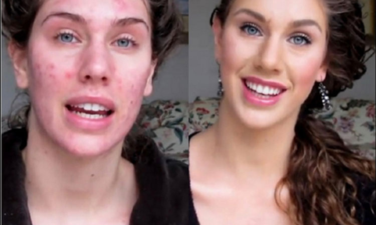 make-up-acne-9-effective-steps