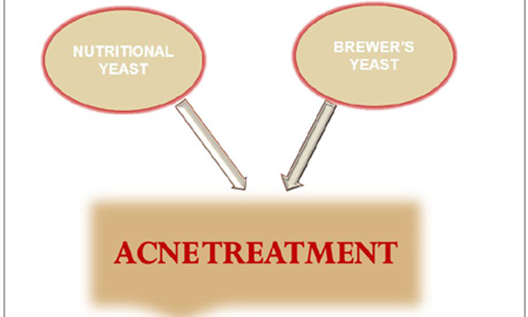 brewer-yeast-9-effective-steps