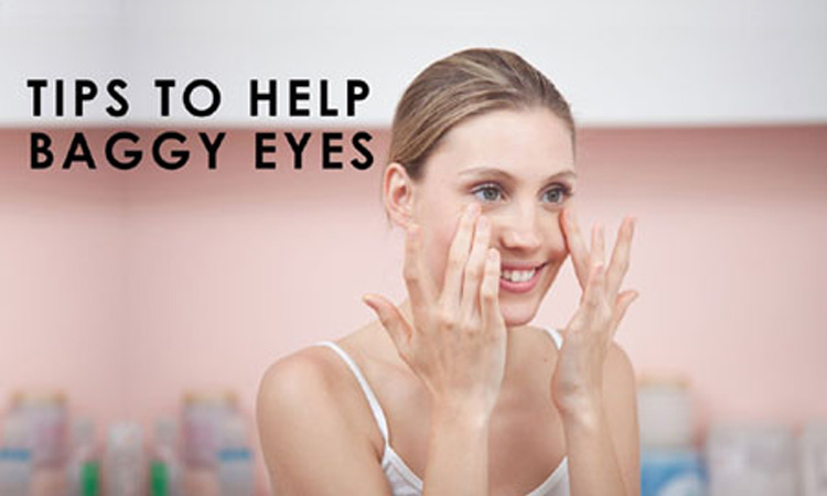 tips-baggy-eyes