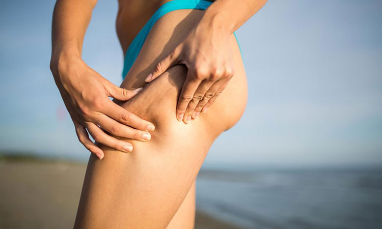 cellulite on How To Fight Cellulite In Simple And Effective Ways