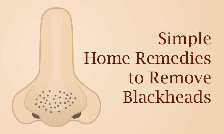 DIY Blakhead Removal on 5 Do it yourself Masks That Are Effective In Eliminating Blackheads 
