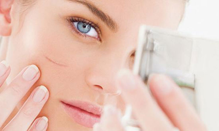 scar face essential oil