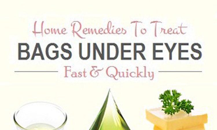 home-remedies-baggy-eyes