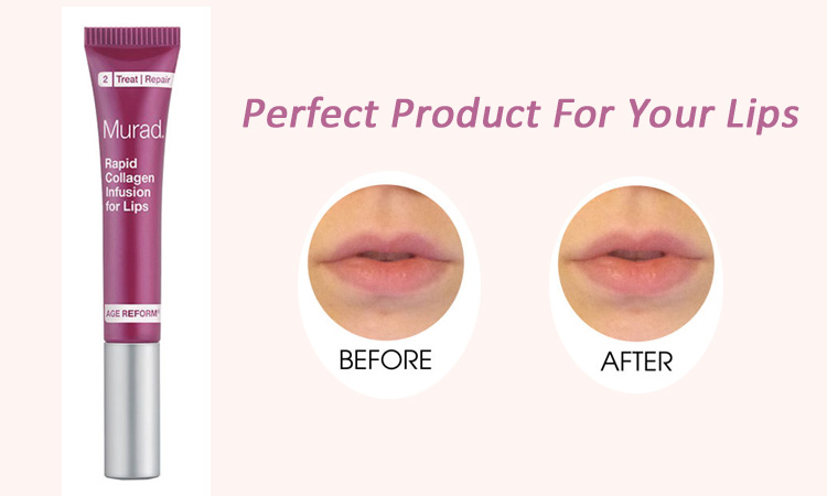 lip-injection-collagen