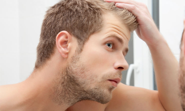 Man Losing hair on 7 Tips To Regrow Hair Naturally