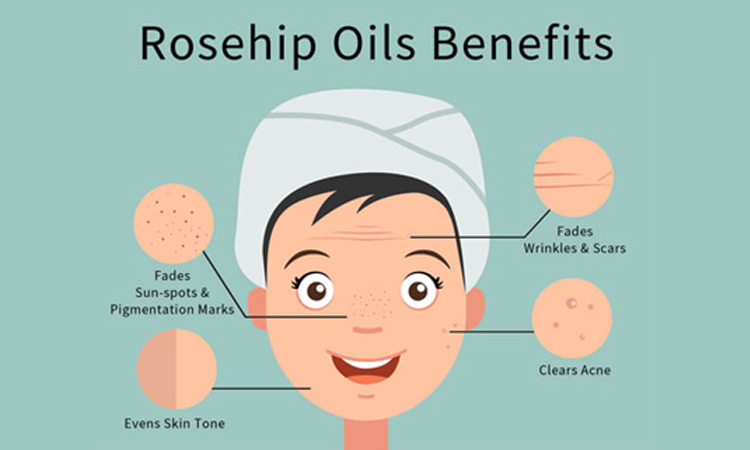 Rosehip Vitamin on Benefits Of Rosehip Oil For Hair And Skin