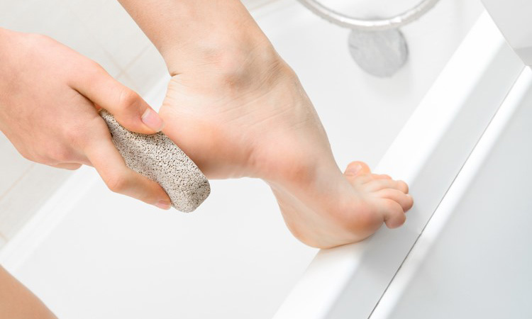 Pumice stone on 6 Methods To Eliminate Cracked Heels